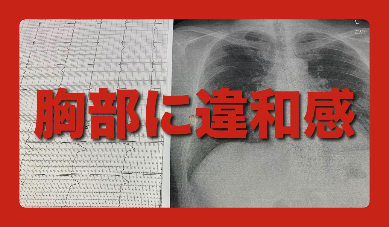 40代のおっさん 胸部 みぞおち周辺 に違和感を感じ病院へ行く の巻 ごりらのせなか